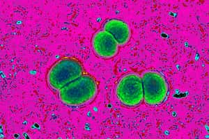 Las autoridades sanitarias de Estados Unidos lanzaron una alerta tras la muerte de una persona y la hospitalización de otras cuatro debido a que registraron casos de meningitis micótica, luego de someterse a procedimientos quirúrgicos en México. (Photo by: BSIP/Universal Images Group via Getty Images)