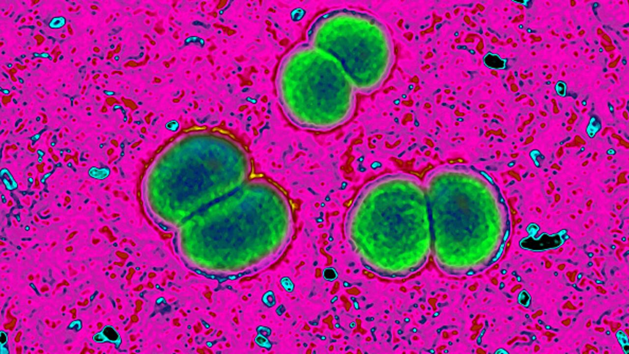 Las autoridades sanitarias de Estados Unidos lanzaron una alerta tras la muerte de una persona y la hospitalización de otras cuatro debido a que registraron casos de meningitis micótica, luego de someterse a procedimientos quirúrgicos en México. (Photo by: BSIP/Universal Images Group via Getty Images)