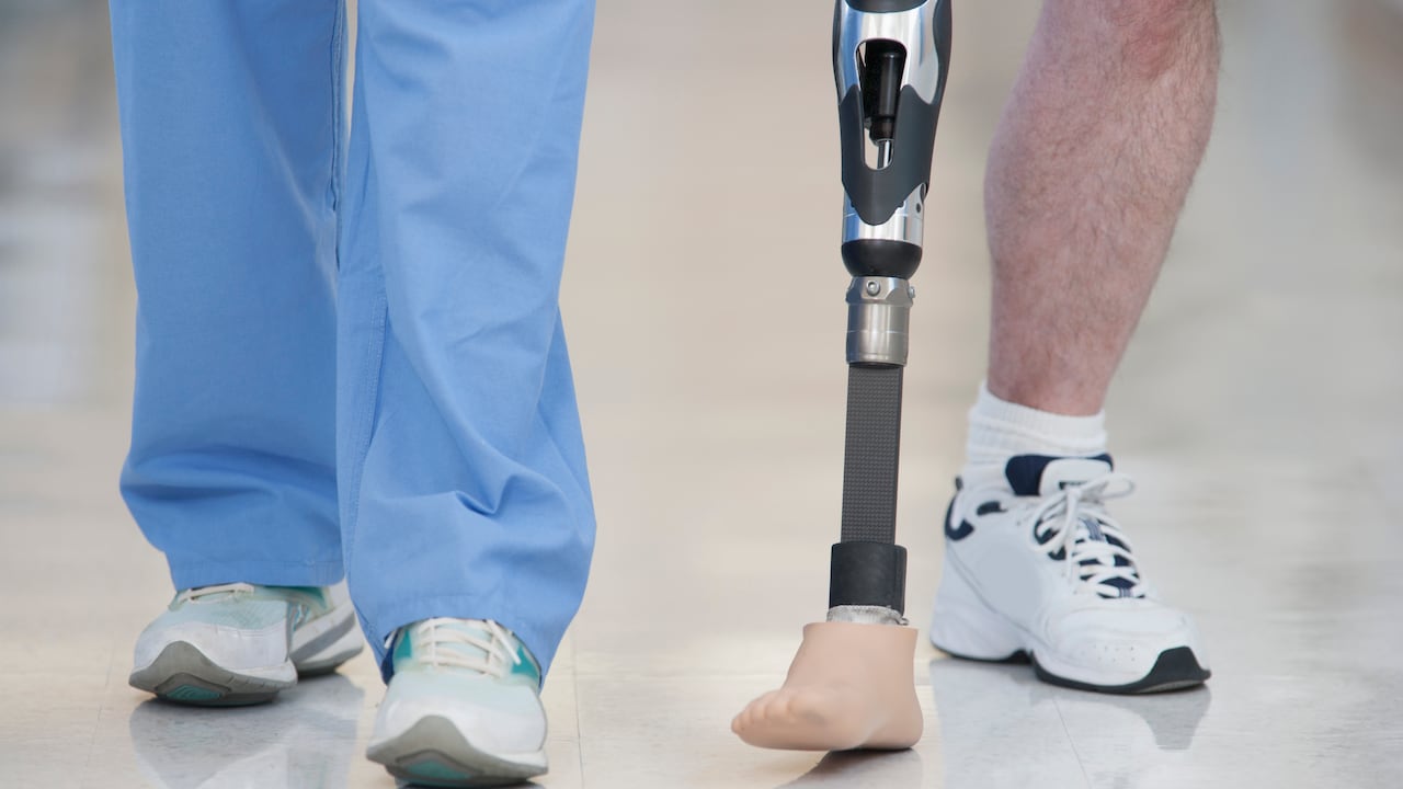 Proceso de recuperación tras una amputación.