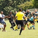 Brutal golpiza de varios futbolistas a árbitro en la Liga de fútbol aficionado en Cali provocó al juez Pablo Ramos fractura de mandíbula cirugía producto de los golpes, pistones y patadas que recibió.