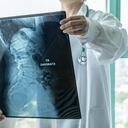 Doctor quirúrgico que mira la película de rayos X de la espina radiológica para el diagnóstico médico en la salud del paciente en la enfermedad de la columna vertebral, enfermedad del cáncer de hueso, atrofia muscular espinal, concepto de salud médica