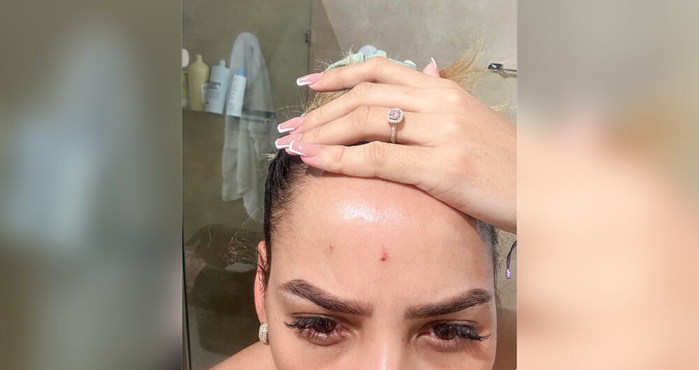   La denunciante entregó a la Fiscalía fotos y videos de las supuestas agresiones de las que habría sido víctima. 