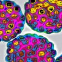 La vacuna está diseñada para pacientes que ya están contagiadas con VPH.