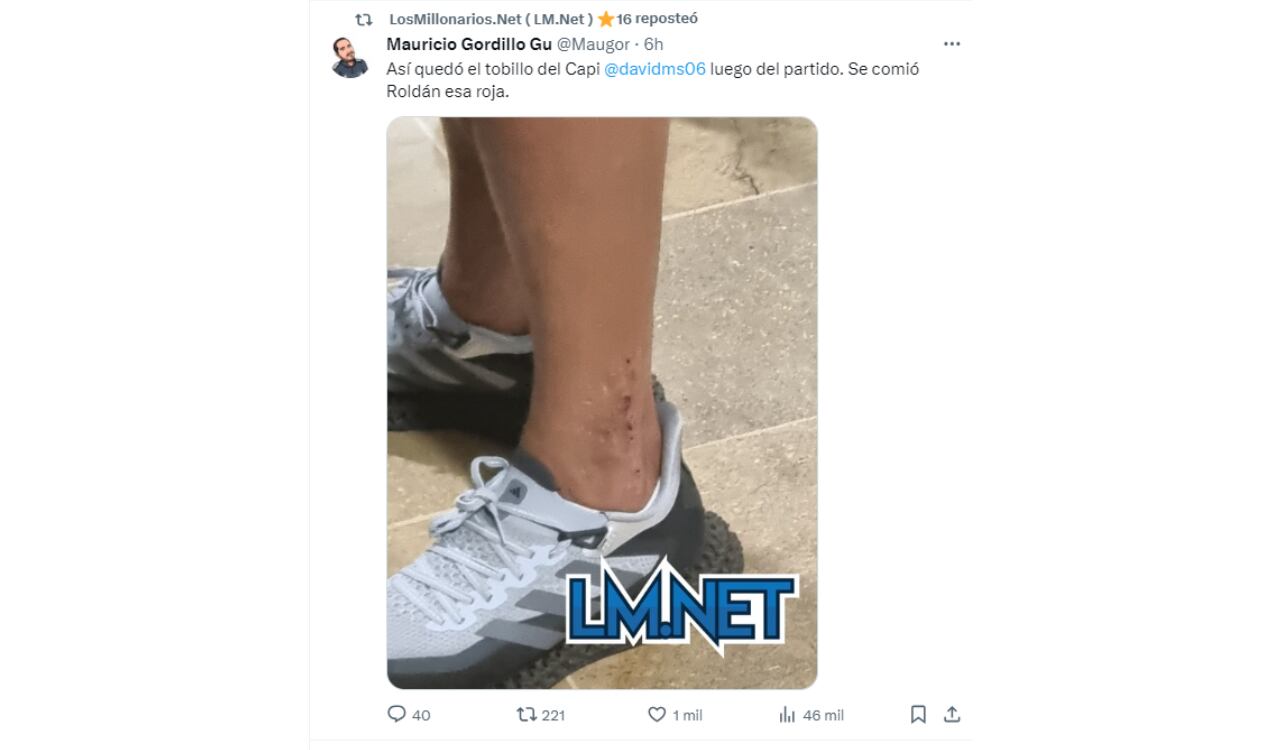 Tobillo de Macalister Silva tras la final ante Junior