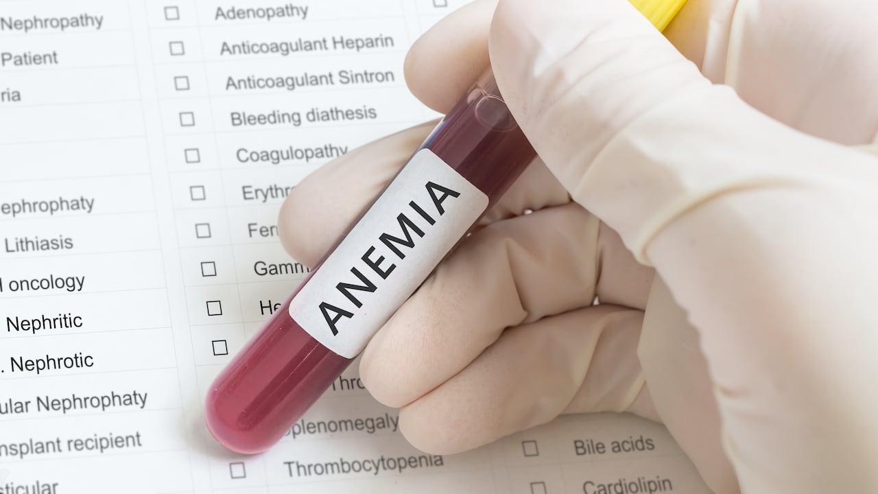 La anemia es una afección relacionada con la sangre.