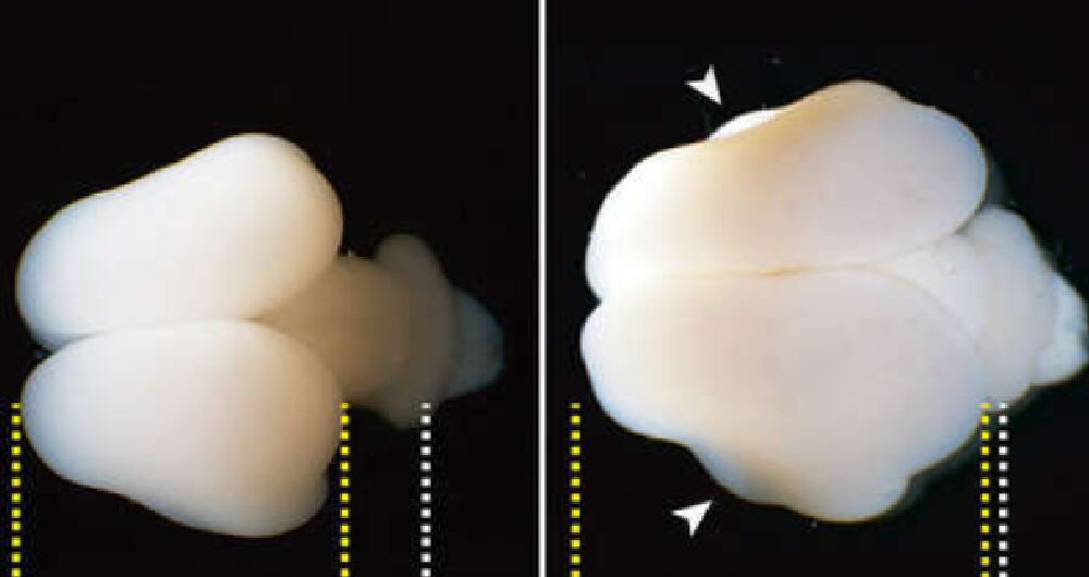 Insertan genes humanos en fetos de monos titíes y logran que les aumente el cerebro.
