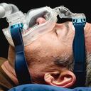 La apnea es una obstrucción derivada de la anatomía del cuello o de la obesidad, que se resuelve con el APPC, pues inyecta aire a presión. Con esa sencilla solución, se reduce el riesgo de demencia.