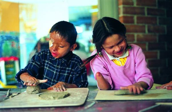 Rehabilitación Mónica, de siete años, vive en la zona rural del municipio de San Pablo, Bolívar, y fue víctima de una mina antipersonal. Moisés, de seis años, de un artefacto y explosivo. Ella perdió la mano derecha y unas cuantas falanges de la mano izquierda. Moisés espera un trasplante de cornea para recuperar la visión de uno de sus ojos. Foto: León Darío Peláez-Revista Semana.