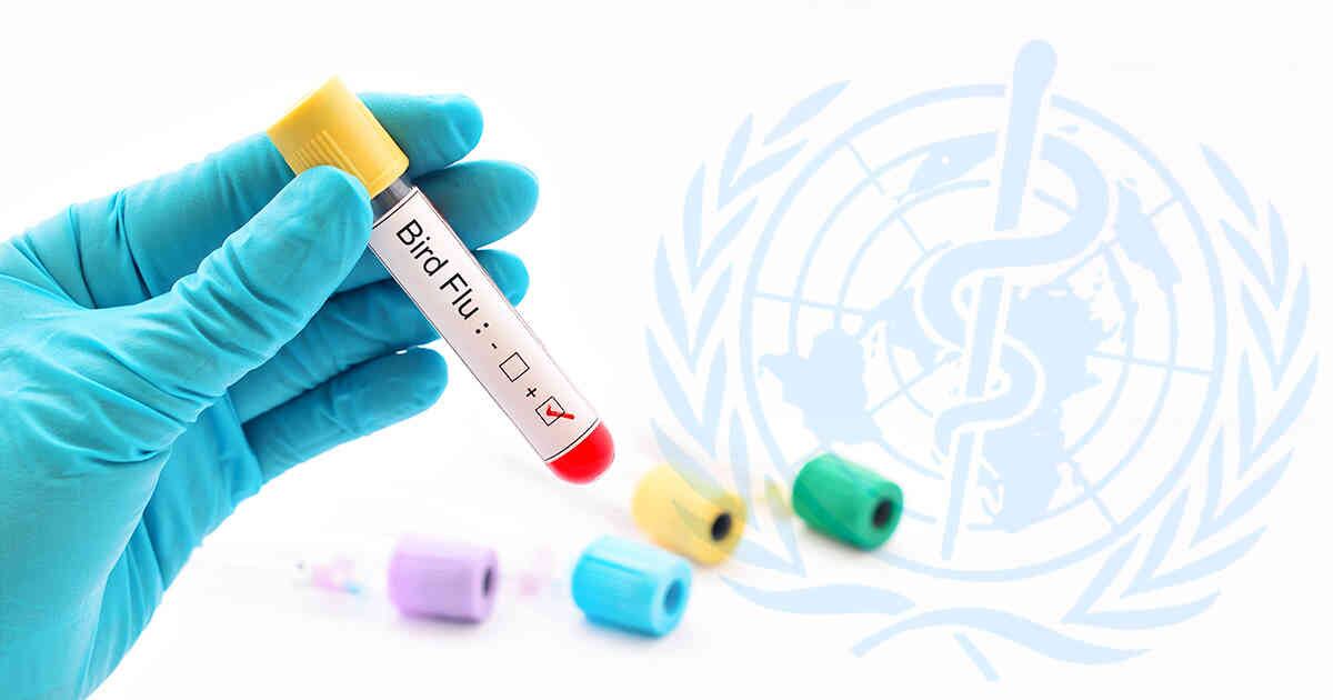 Gripe aviar 