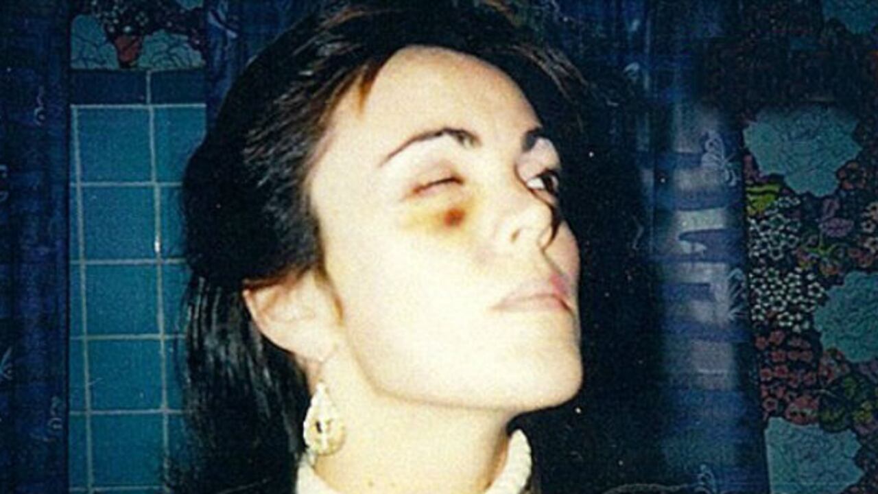 La mamá de la actriz Lindsay Lohan dice haber sido golpeada y violada por su ex esposo.