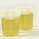 Un ser humano produce en promedio entre 800 y 2.000 mililitros de orina por día.