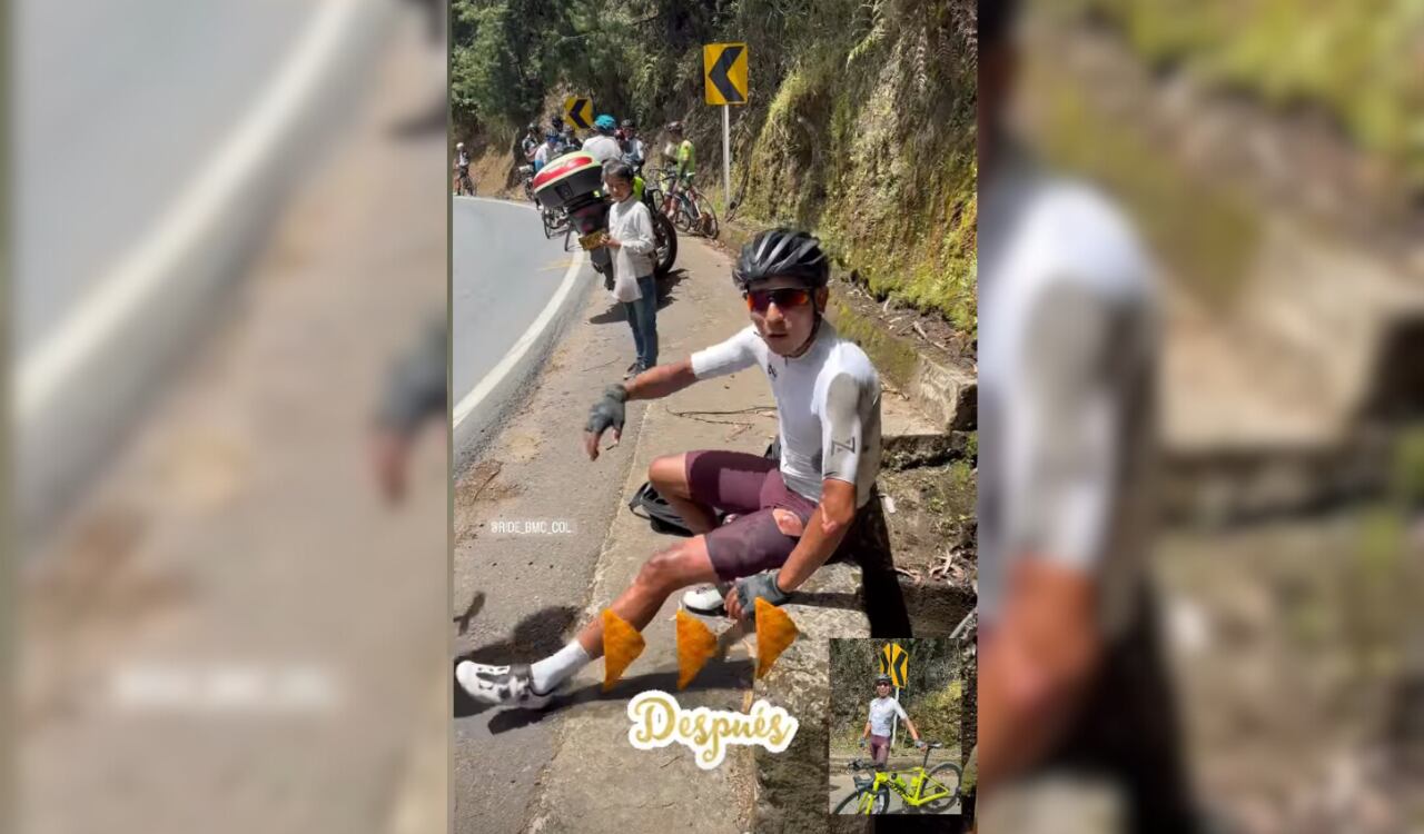 Nairo Quintana mostró el antes y después de su accidente en Colombia.
