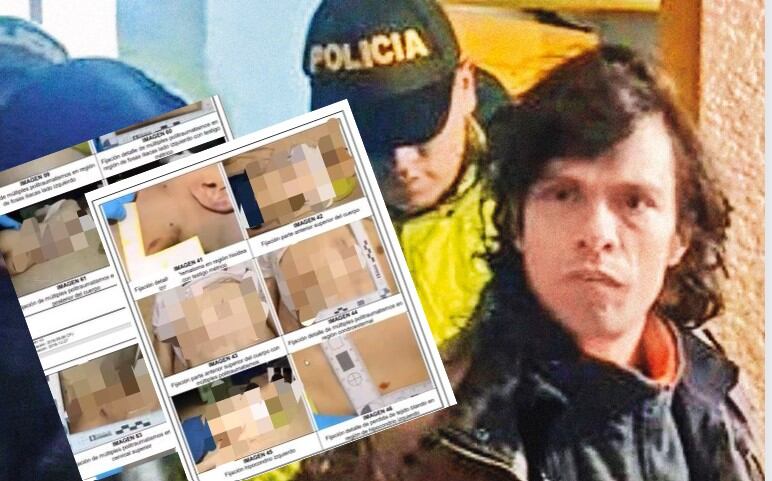 La Fiscalía reveló detalles de la necropsia hecha al cuerpo de Juan Pablo González, el presunto abusador de Hilary. Más de 50 golpes y fracturas.