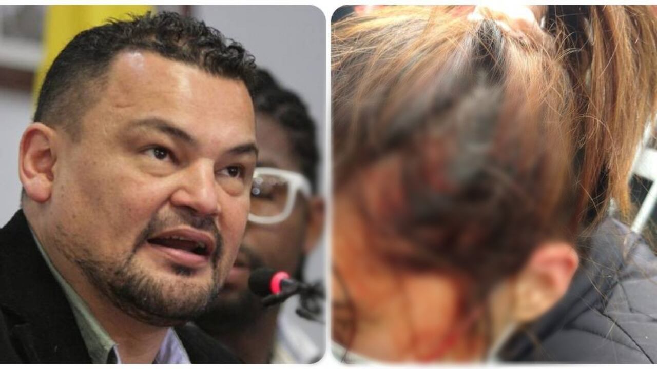 La falsa denuncia de un congresista del Partido Comunes frente al paro