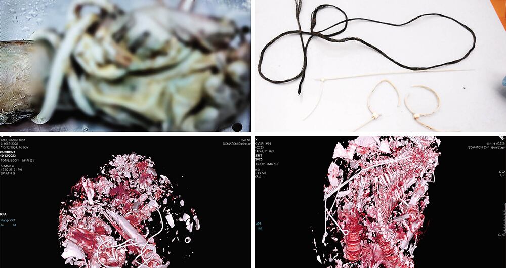 Restos de cuerpos humanos destrozados y pulverizados por los salvajes de Hamás.