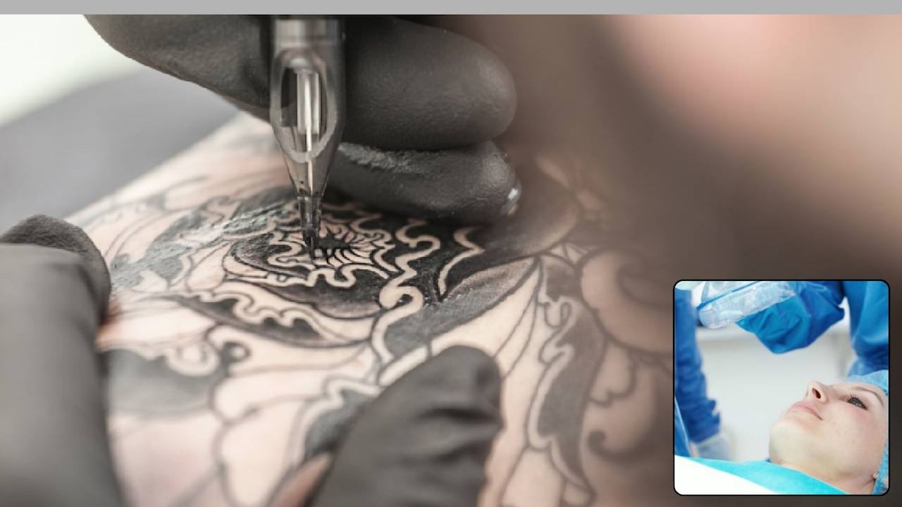 La realización de tatuajes bajo sedación fuera de instituciones autorizadas generó alertas entre especialistas, quienes advierten que estos procedimientos pueden derivar en complicaciones graves si no cuentan con las condiciones médicas adecuadas.