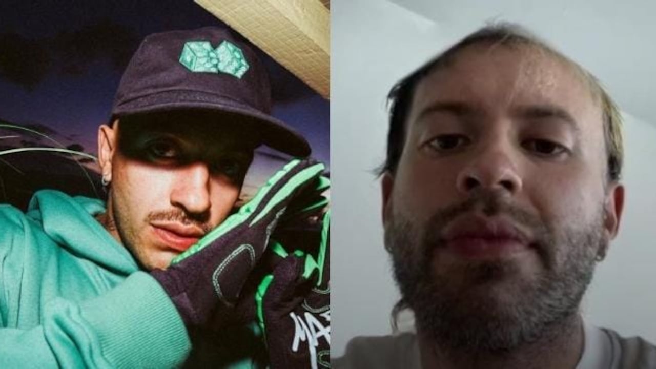 En un video de TikTok, se muestran fotos del artista en donde al parecer tiene problemas de calvicie.