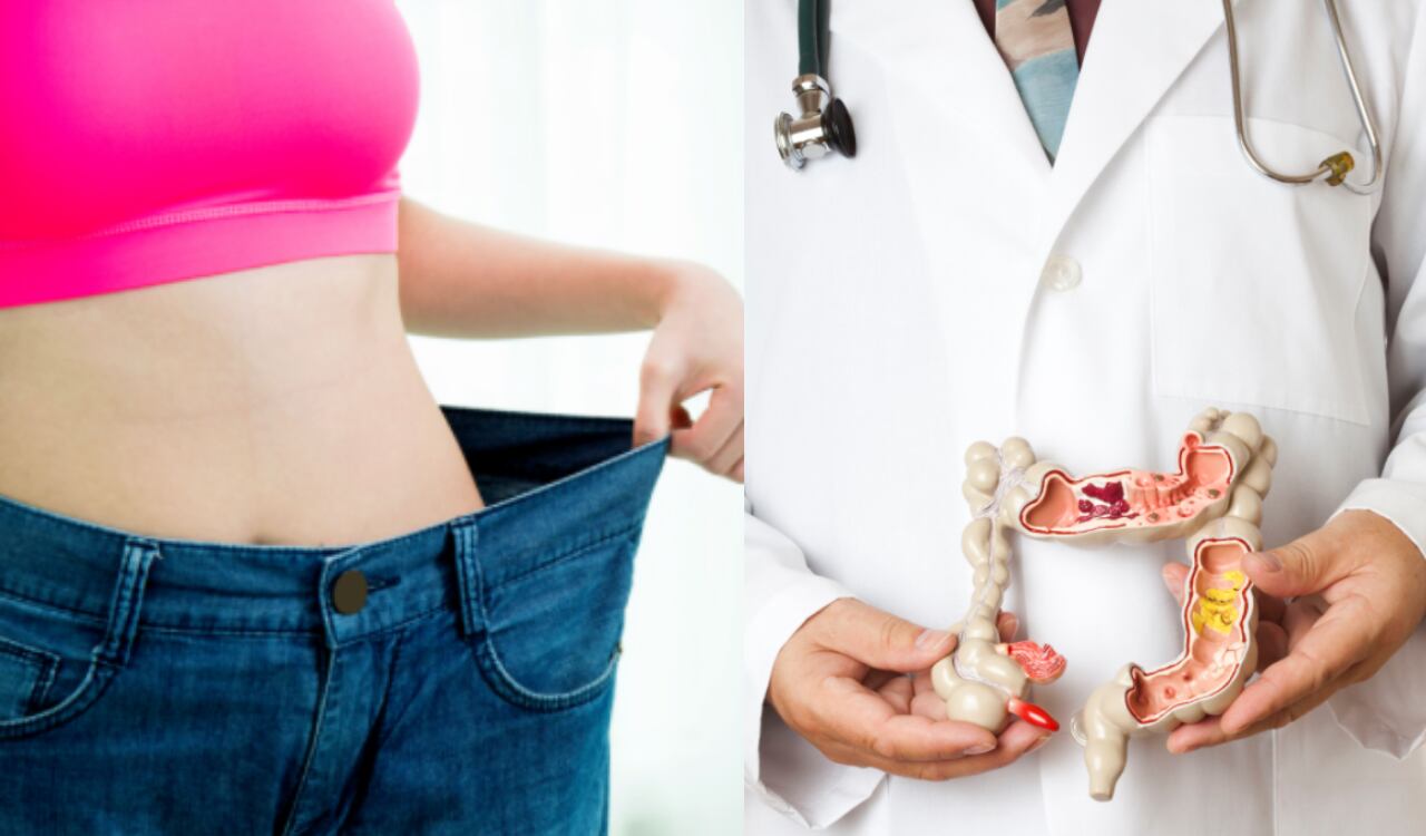 Colon, perder peso, adelgazar