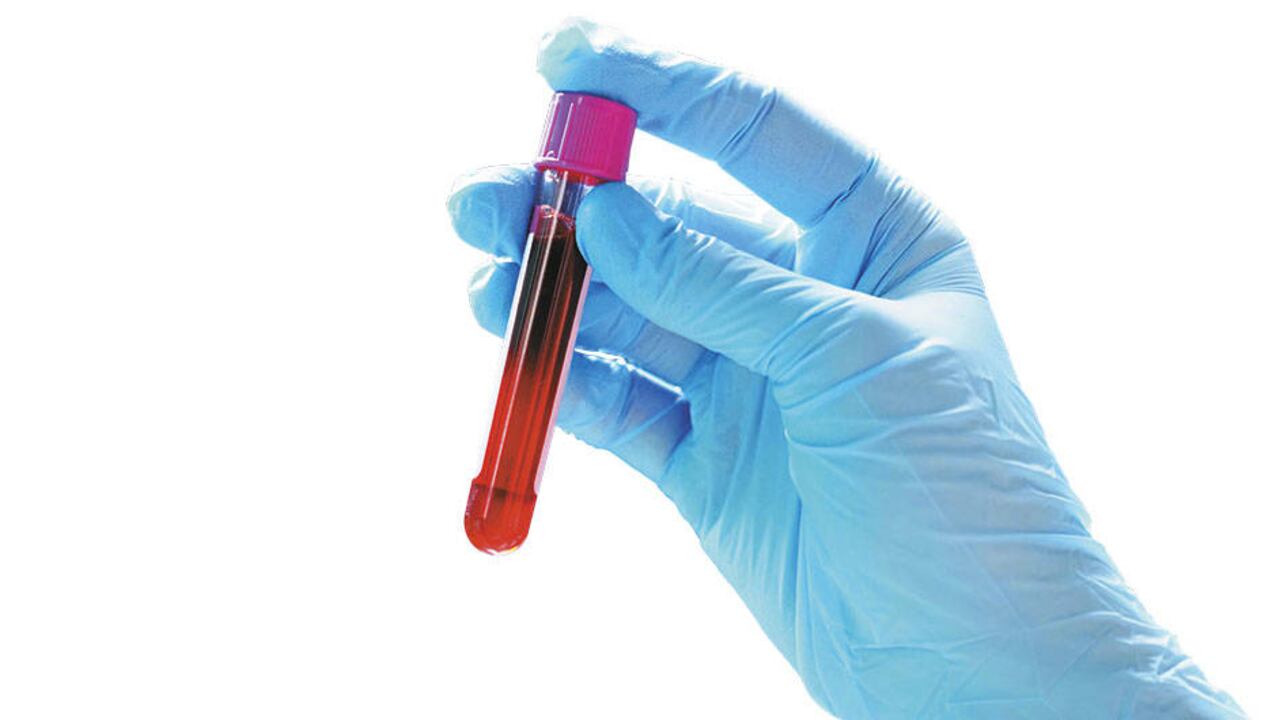 Los autores afirmaron que esperan pasar a ensayos clínicos en humanos "lo más rápido posible".