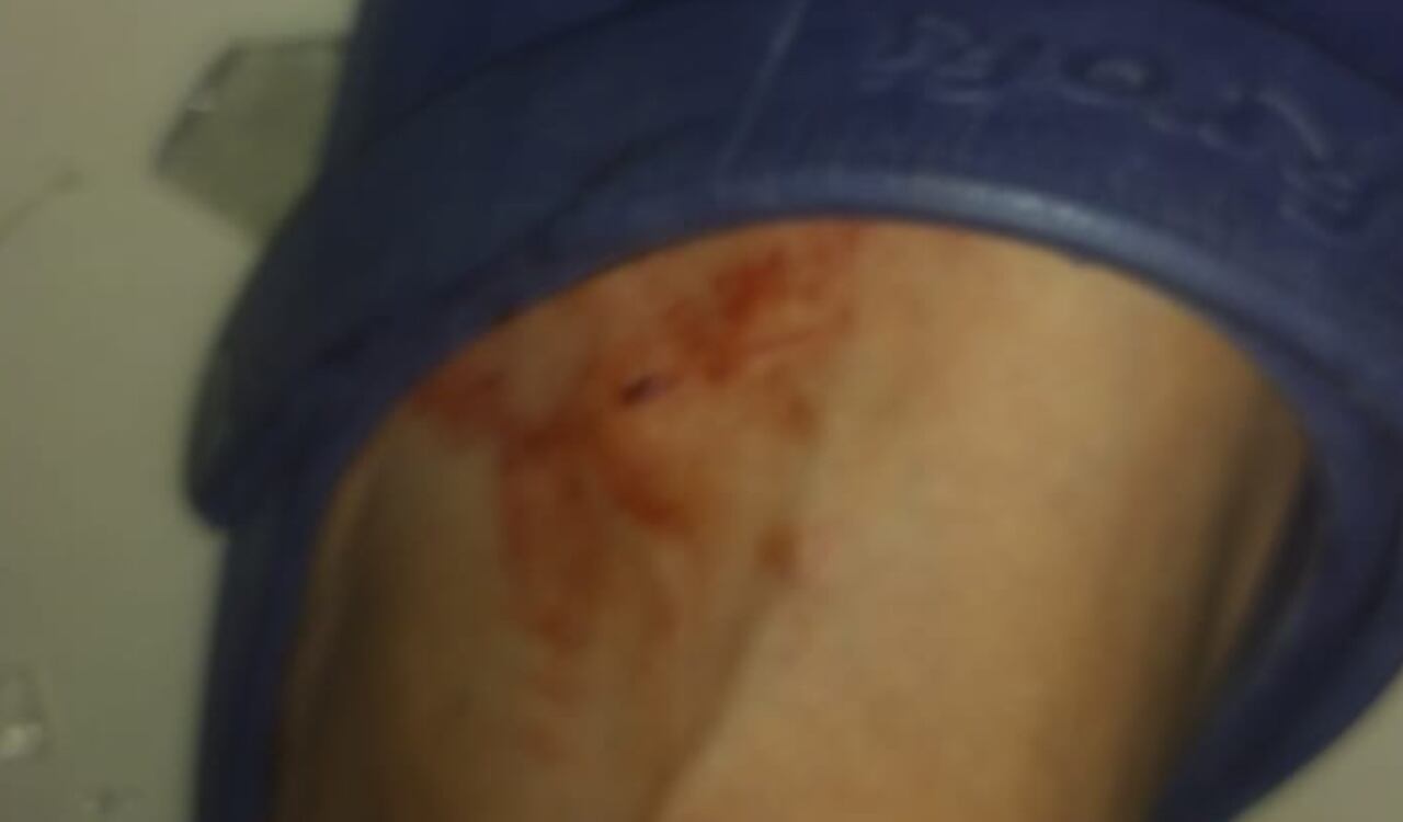 Varios heridos, algunos con mayor gravedad que otros, dejó el atentado terrorista en Saravena, Arauca