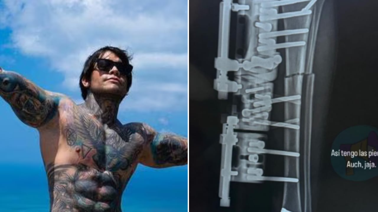 Yeferson Cossio reveló que se mandó a realizar un procedimiento para alargar sus piernas.