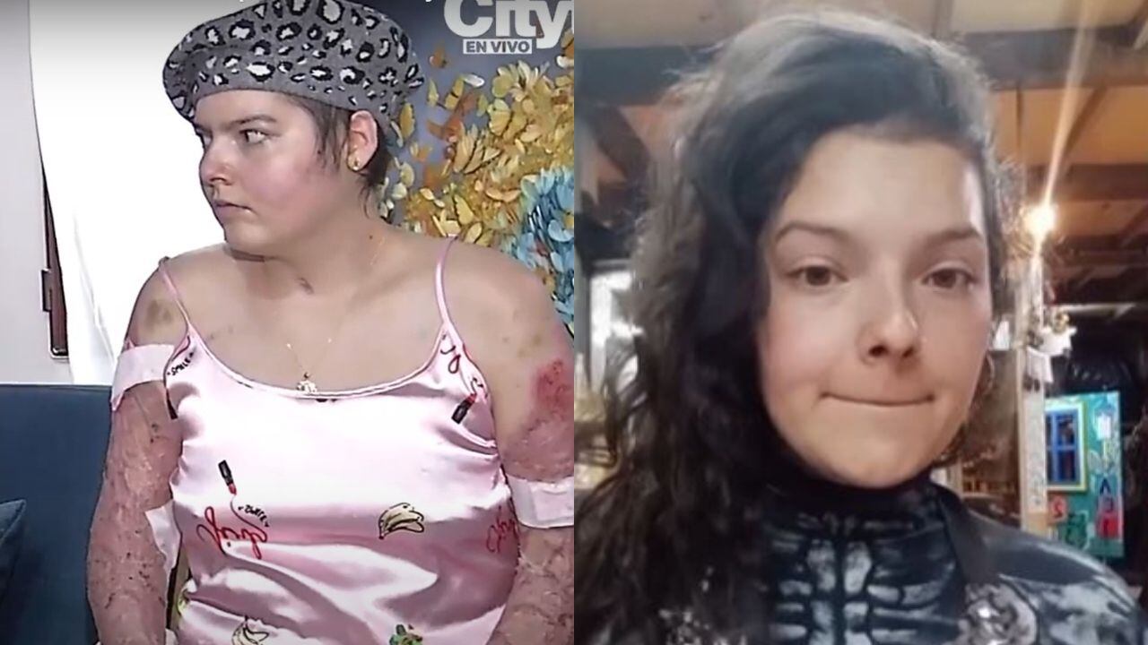 La joven habló de cómo avanza su recuperación.