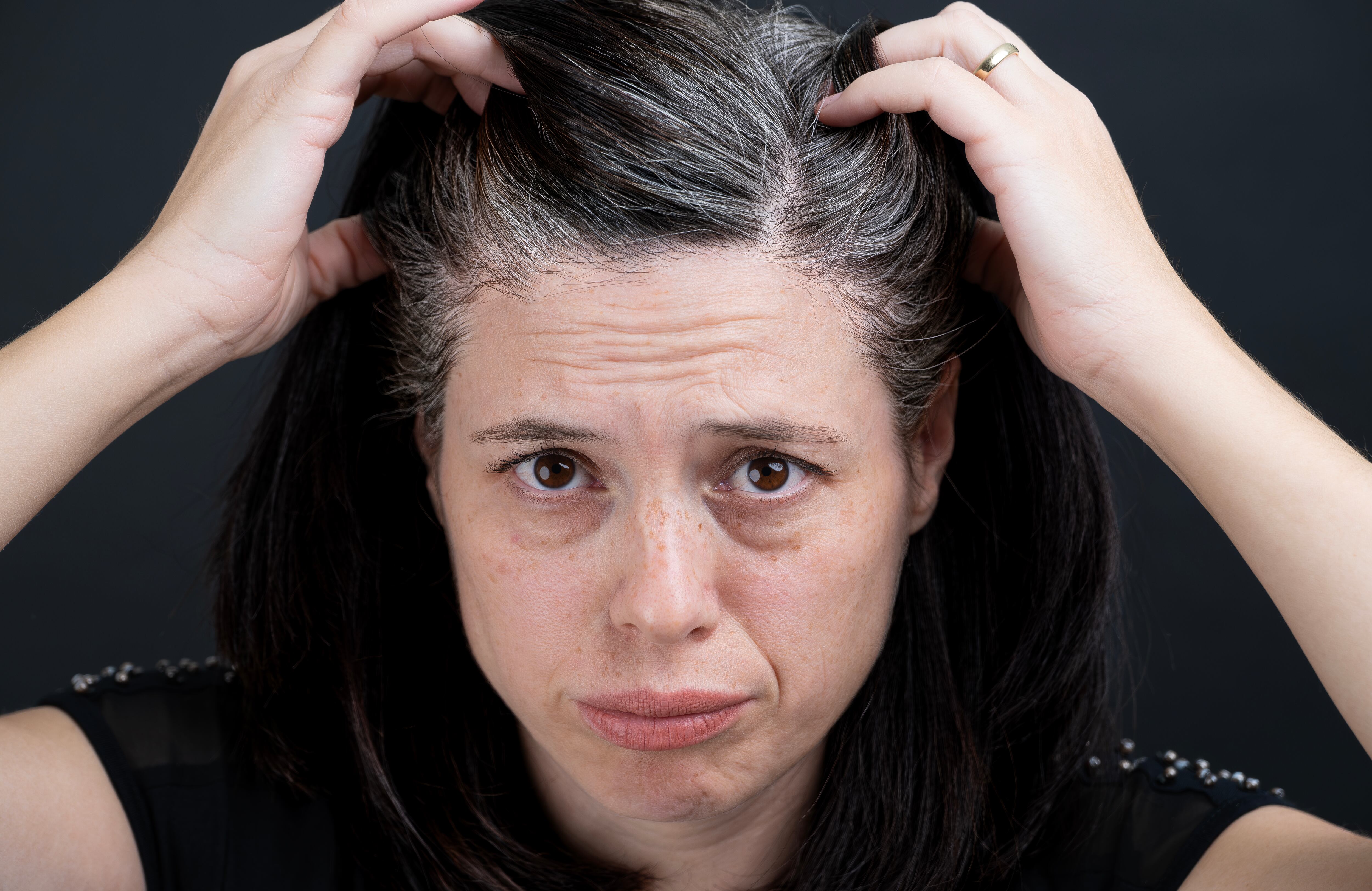 Las canas aparecen debido a una combinación de factores biológicos y genéticos.