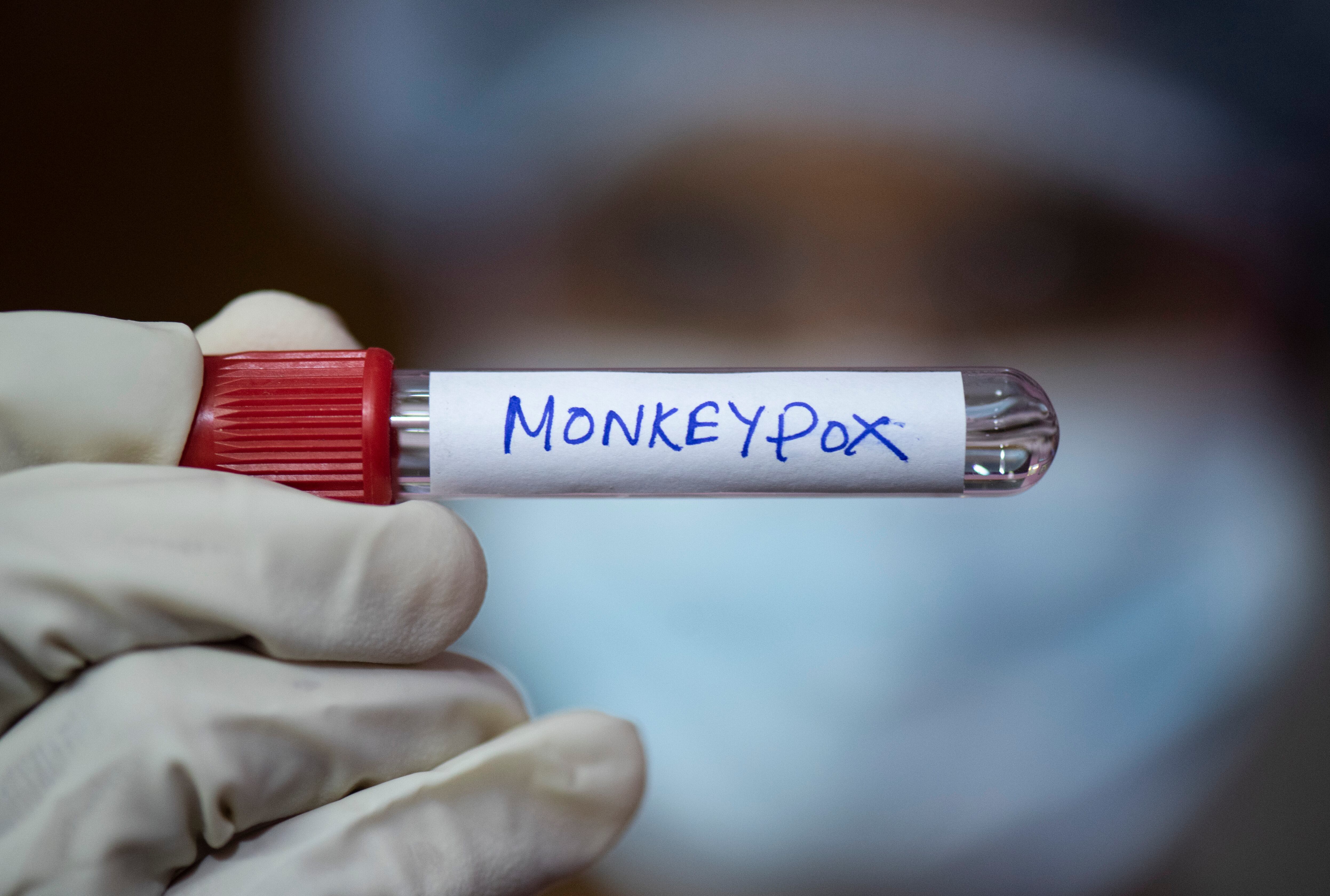 Monkeypox virus o viruela del mono