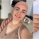 La historia de Adriana Becerra: entre el cáncer de mama y la espera por un tratamiento sin interrupciones.