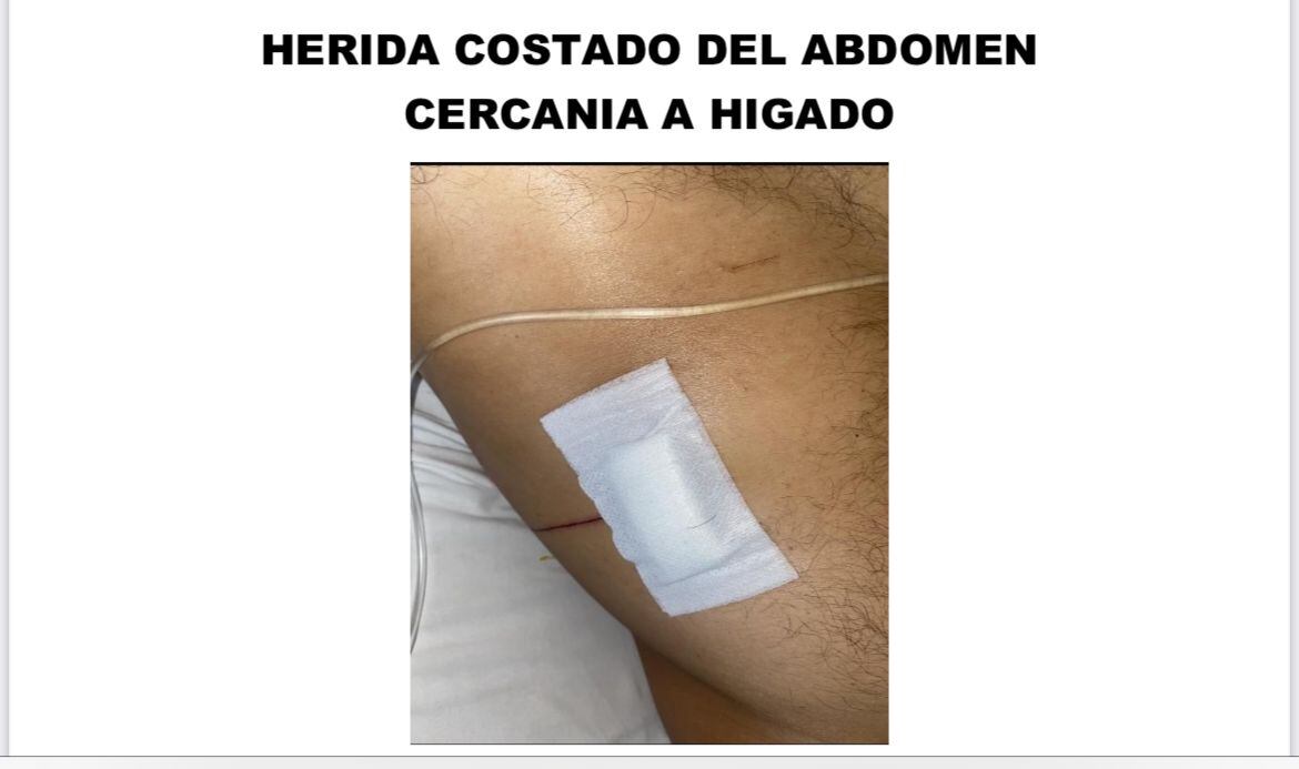 Imágenes de las heridas que sufrió Mauricio Gutiérrez.