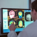 Foto referencia sobre cerebro.