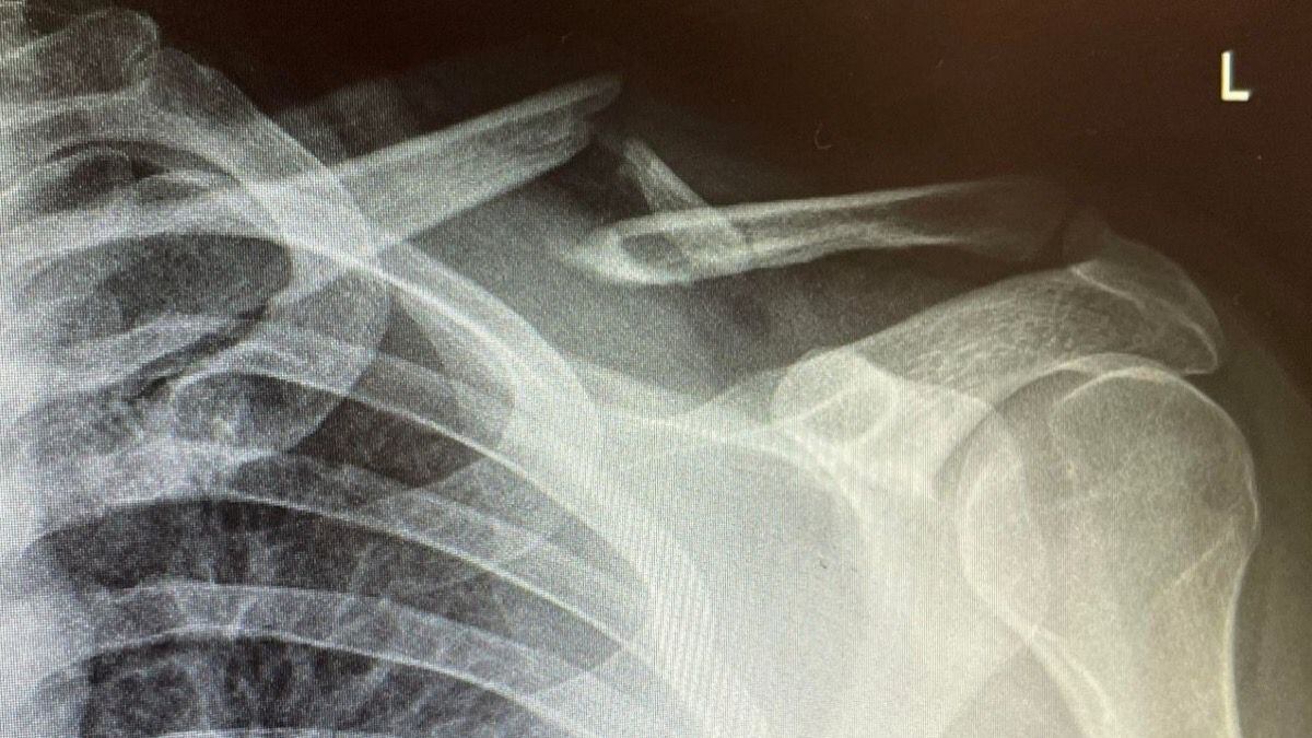 Radiografía Skill Specs