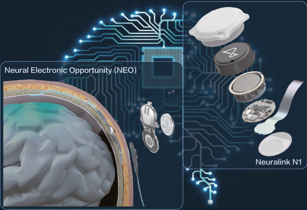 China aprueba NEO, el chip cerebral mínimamente invasivo que compite con Neuralink