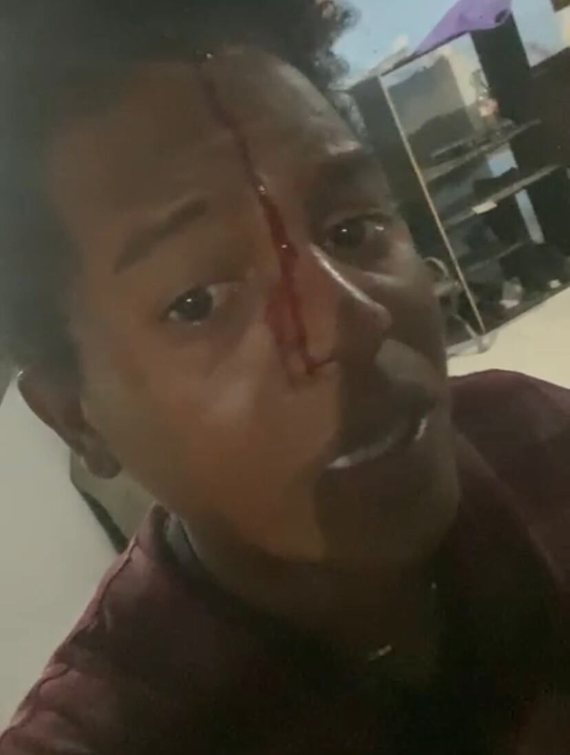 Denuncia de agresión.