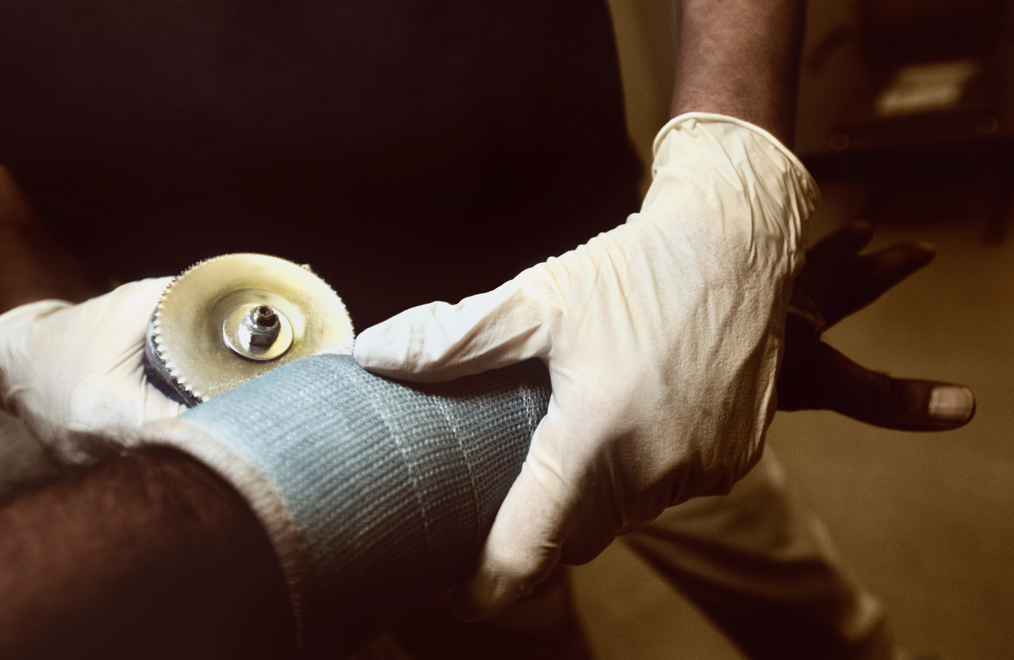 La cantidad de quemados con pólvora entre diciembre y lo corrido de enero es de 930 personas.