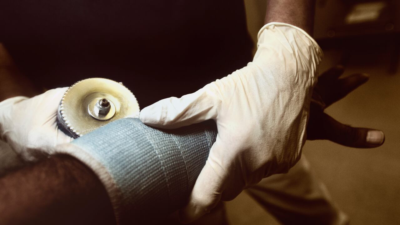 La cantidad de quemados con pólvora entre diciembre y lo corrido de enero es de 930 personas.