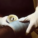 La cantidad de quemados con pólvora entre diciembre y lo corrido de enero es de 930 personas.