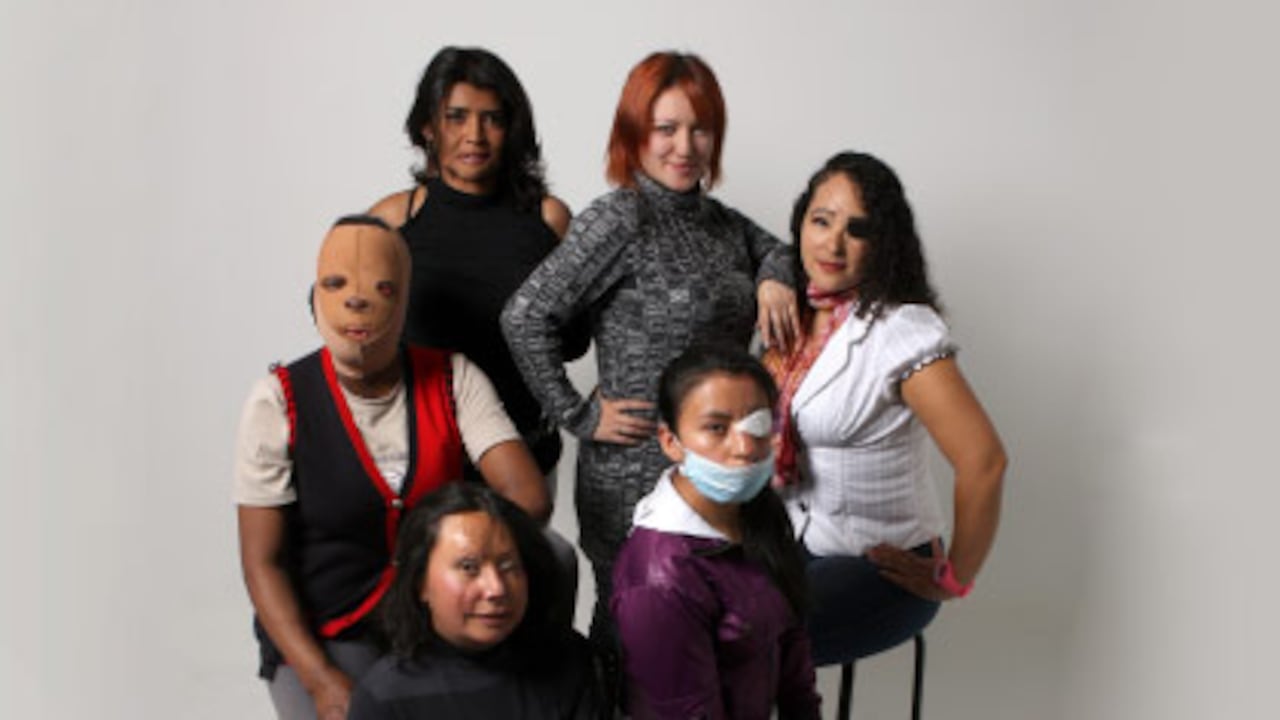 A inicios de febrero seis mujeres quemadas con ácido decidieron hacer visible un drama y un crimen y le contaron a SEMANA sus historias.