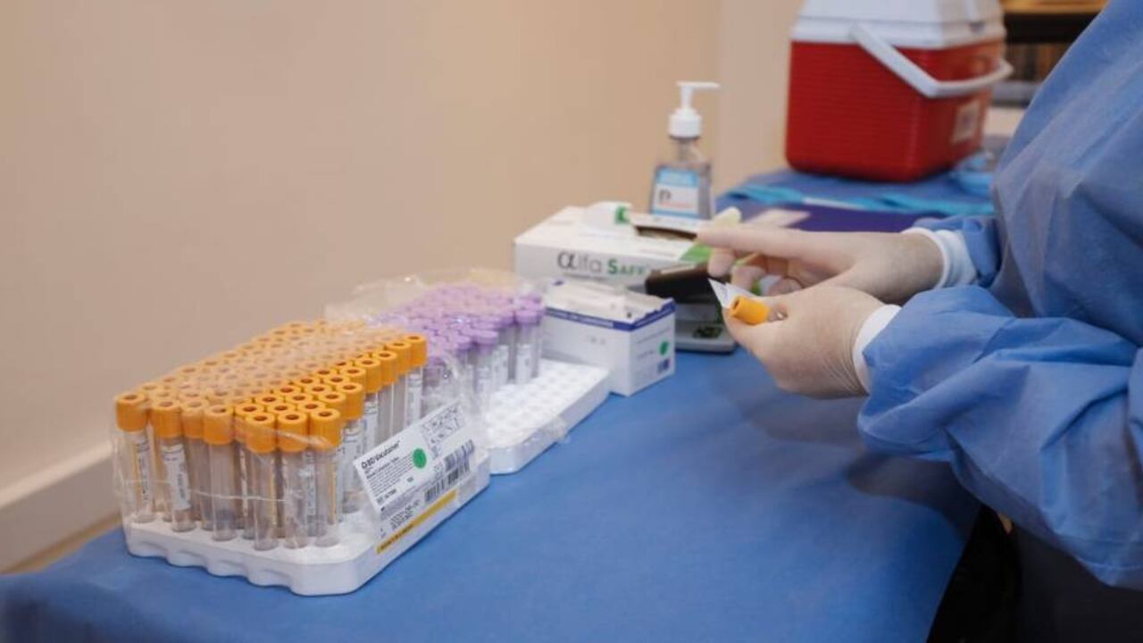 Coronavirus: Procuraduría advierte que 15.053 resultados no han sido entregados/Foto: Guillermo Torres/SEMANA