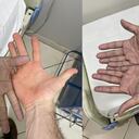 Finalmente el mismo paciente logró entregar el dato más importante para su diagnóstico. Foto: Twitter @AleGinzo_MD.