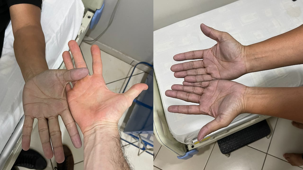 Finalmente el mismo paciente logró entregar el dato más importante para su diagnóstico. Foto: Twitter @AleGinzo_MD.