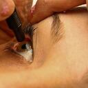 En lo corrido del 2017 van 18 casos de ceguera en todo el país y solamente en Cali son 13.