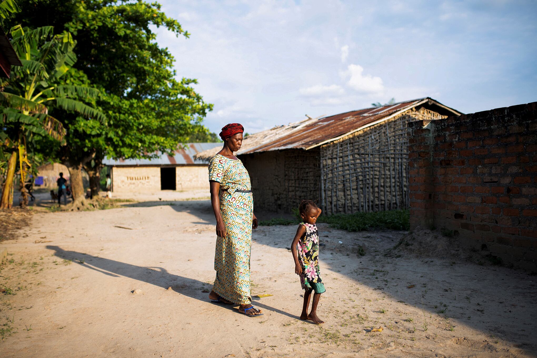 En imágenes : En el brote de viruela del mono en África, la enfermedad y la muerte pasan desapercibidas