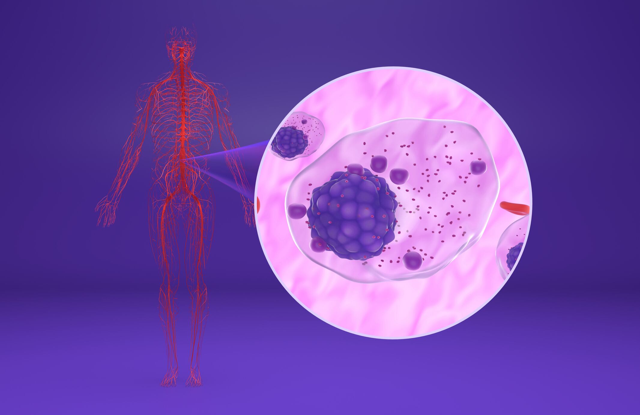 Cada año se diagnostican más de 1,2 millones de nuevos casos de cáncer hematológico en el mundo.