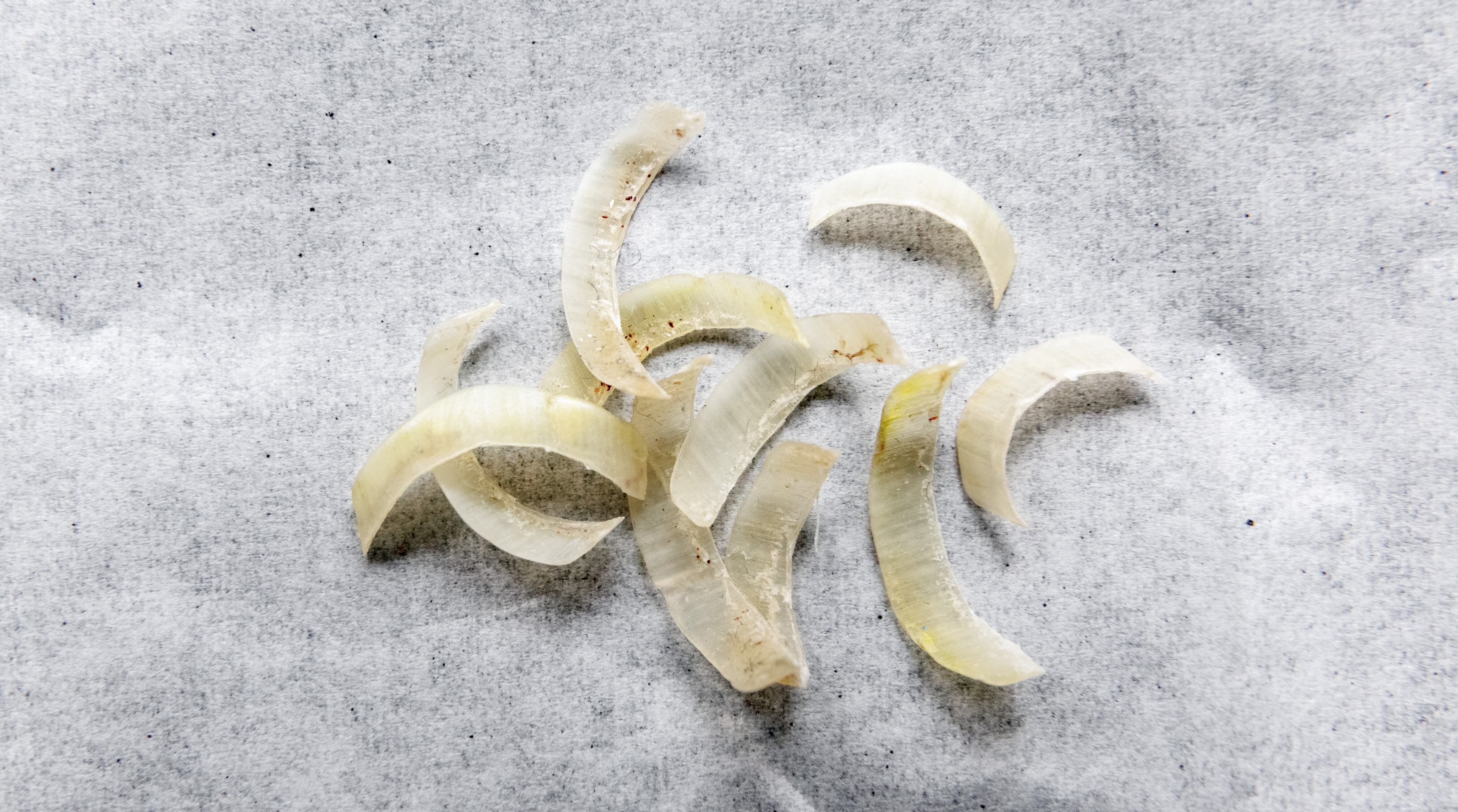 27 December 2022, Hamburg: Cut fingernails lie on a napkin. Photo: Markus Scholz/dpa (Photo by Markus Scholz/picture alliance via Getty Images)