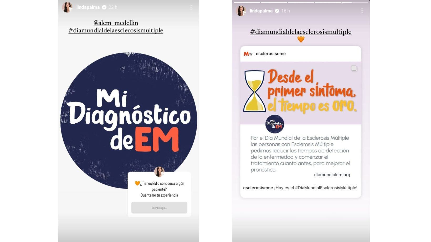 Linda Palma compartió sentida reflexión para los pacientes que padecen esclerosis múltiple: “Podemos seguir llenos de vida"