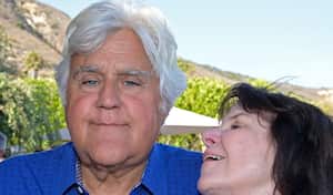 Jay Leno sufrió quemaduras en su rostro
