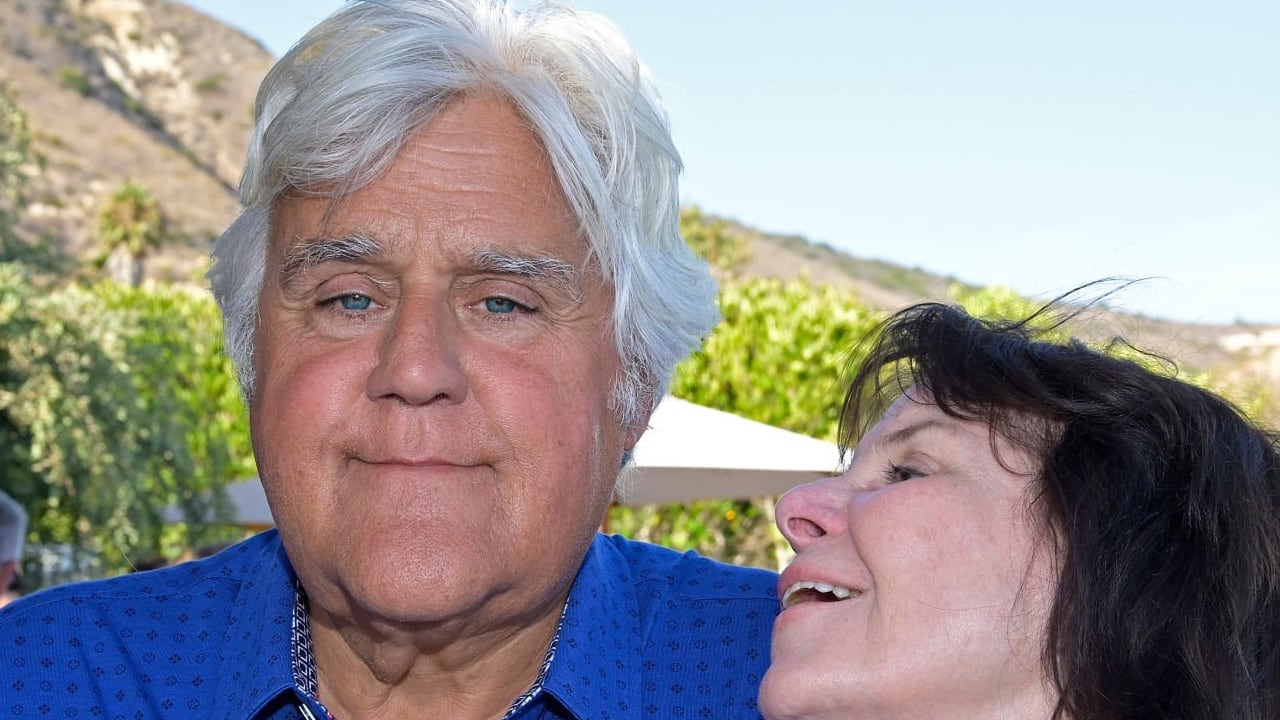 Jay Leno sufrió quemaduras en su rostro.