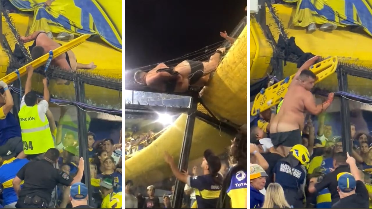 Seguidor de Boca en Argentina, se vio sumamente lastimado en su cuerpo.