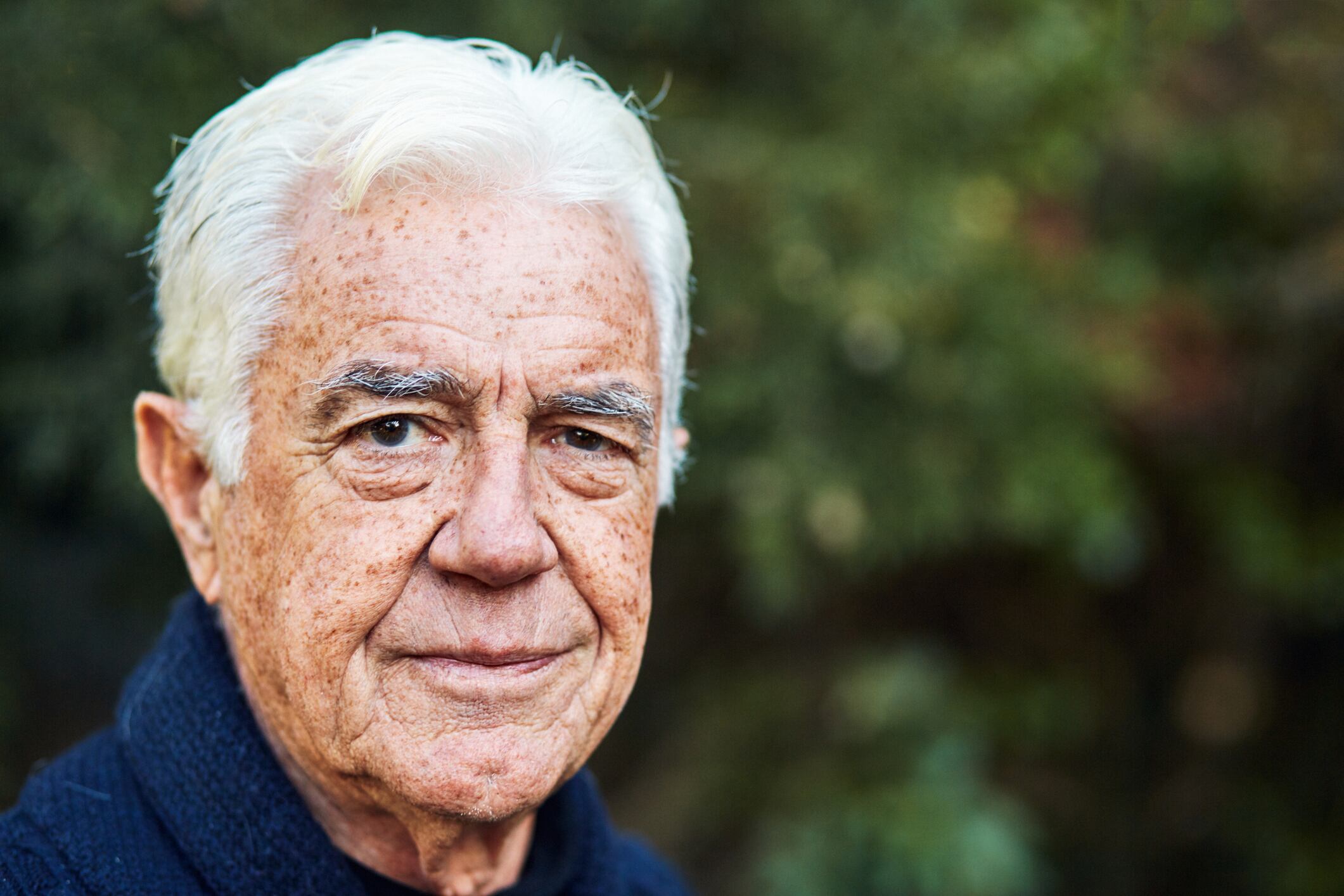 Manchas hepáticas - Adulto Mayor